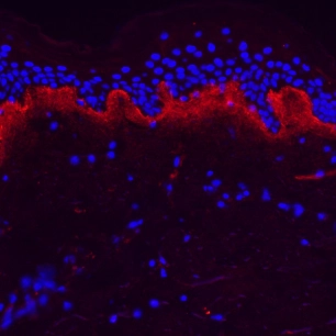 Without Pure Retinol